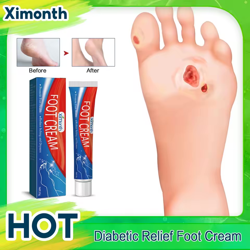 Ximonth Diabetic Relief Foot Cream